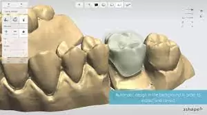 Software CAD CAM Exocad 3.1 Rijeka para odontologí